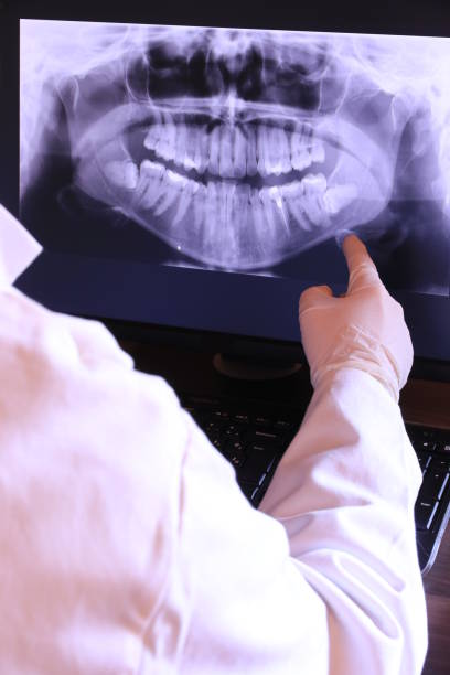 Best Emergency Tooth Extraction in Blue Rapids, KS