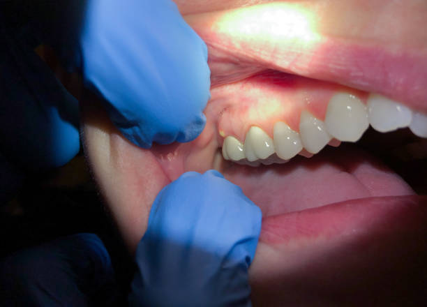 Best Cosmetic Emergency Dentistry in Blue Rapids, KS
