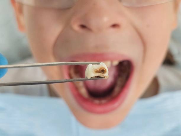 Best Pediatric Emergency Dentist in Blue Rapids, KS